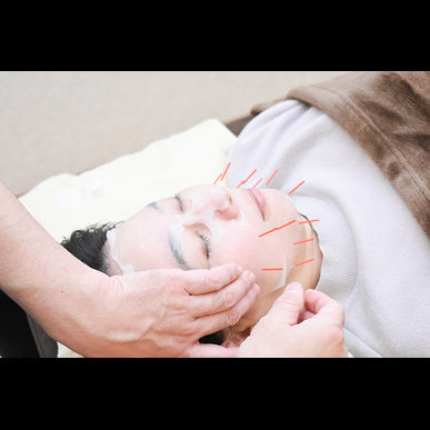 よつば鍼灸整骨院の「再生医療」×「美容鍼」次世代型美容鍼でお肌を若返らせませんか！？