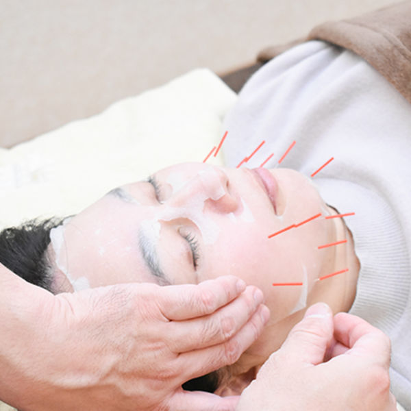よつば鍼灸整骨院の「再生医療」×「美容鍼」次世代型美容鍼でお肌を若返らせませんか！？